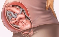 7 hiện tượng kỳ lạ nhất khi mang thai
