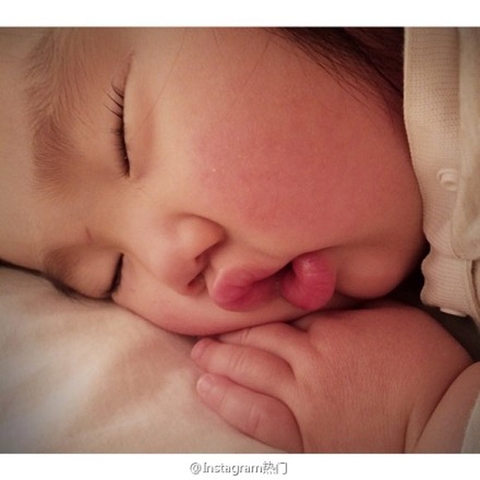 Mụn trứng cá ở trẻ, bác sĩ nói gì? Mụn trứng cá ở trẻ, bác sĩ nói gì?