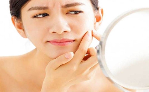 MỤN ẨN LÀ GÌ? NGUYÊN NHÂN VÀ PHƯƠNG PHÁP TRỊ MỤN ẨN DƯỚI DA TỐT NHẤT