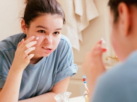 Chăm sóc da mụn tuổi dậy thì