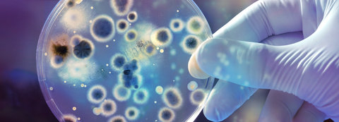 Nhiễm nấm xâm lấn: Bệnh lý nguy hiểm thường bị bỏ sót trong chẩn đoán