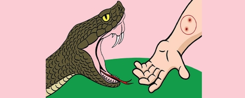 Rắn cắn: Nhận biết dấu hiệu nguy hiểm và cách xử trí đúng cách để bảo vệ tính mạng