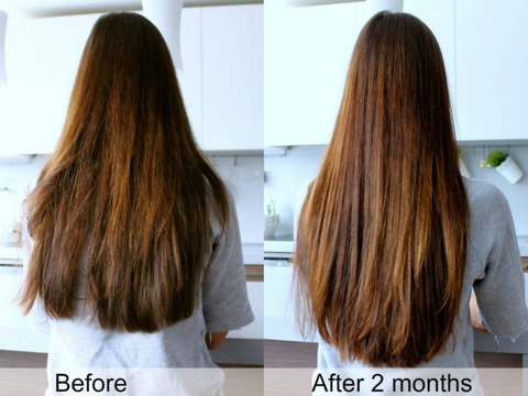 Đừng bỏ qua: 10 loại dầu gội trị rụng tóc và kích thích mọc tóc hiệu quả nhất