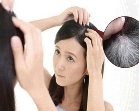 Tóc bạc sớm ở thanh niên nguy hiểm hơn bạn nghĩ