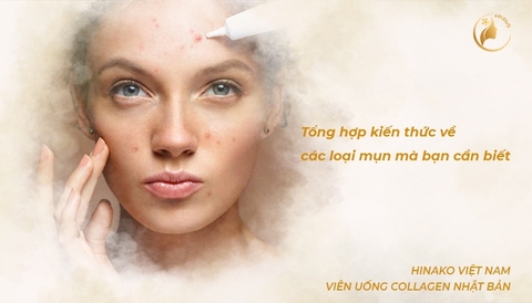 Bách khoa toàn thư về các loại mụn đầy đủ nhất