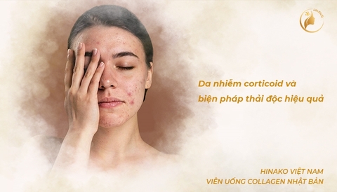 5 cấp độ da nhiễm corticoid và biện pháp thải độc hiệu quả