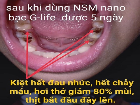 Trải Nghiệm Nước Súc Miệng Green Cool