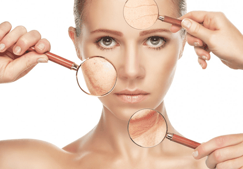 Tìm hiểu về da nhạy cảm là loại da như thế nào?