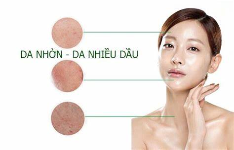 NHẬN BIẾT DA DẦU VÀ CÁCH CHĂM SÓC CHO DA DẦU NHỜN