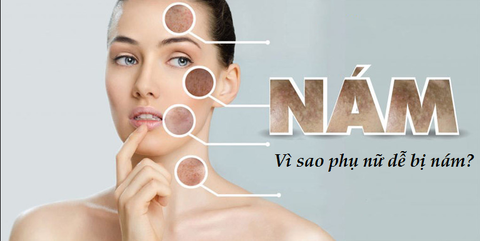 TẠI SAO PHỤ NỮ VIỆT NAM DỄ BỊ NÁM DA ĐẾN VẬY?