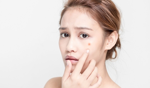 Tiêu chí chọn sữa rửa mặt cho da mụn