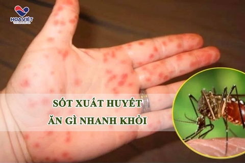 SỐT XUẤT HUYẾT ĂN GÌ NHANH KHỎI?