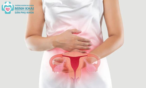 Cách Phòng Ngừa Viêm Nhiễm Phụ Khoa Hiệu Quả Cho Chị Em Phụ Nữ