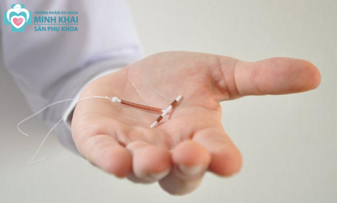 Sinh Mổ Có Đặt Vòng Được Không? Thời Điểm Thích Hợp Để Đặt Vòng