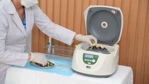Công nghệ PRP - Huyết tương giàu tiểu cầu tự thân