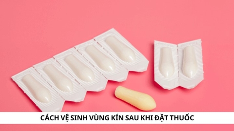 Cách vệ sinh vùng kín sau khi đặt thuốc mà bạn nên biết