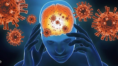 Khái niệm của bệnh viêm não tự miễn