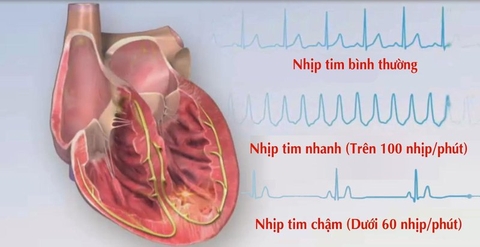 8 nhóm thuốc tim mạch thường dùng