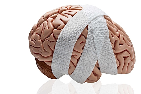 CÁCH TRỊ ĐAU ĐẦU TẠI NHÀ GIẢM NHANH CHÓNG KHÔNG DÙNG THUỐC