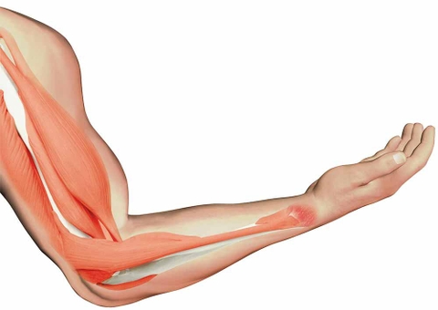 Hội chứng liệt rung Parkinson thứ phát và không điển hình