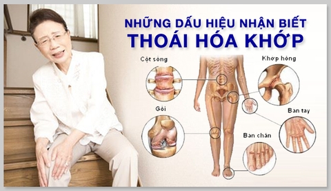6 nguyên nhân thoái hóa khớp không thể bỏ qua để phòng bệnh hiệu quả