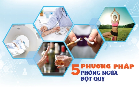 Cách ngừa đột quỵ mà không dùng dược phẩm ngăn ngừa đột quỵ