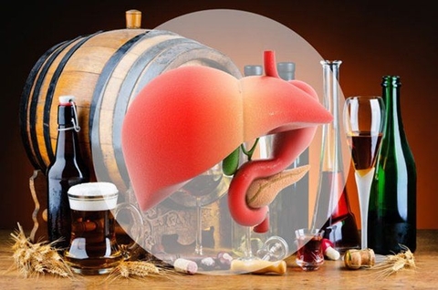 Xơ Gan Do Rượu: Kẻ Thù Âm Thầm Đang Bào Mòn Lá Gan Của Bạn