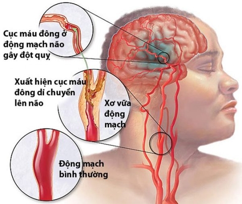Hình ảnh não bộ và các vấn đề thường gặp ở não