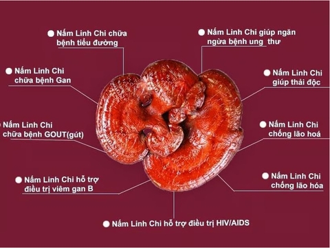 Ung thư ở người trẻ tuổi: Ca bệnh tăng và các mối lo ngại