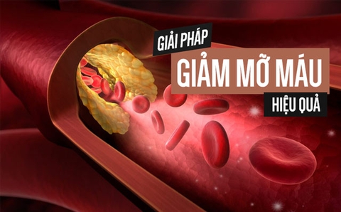 Top 6 thực phẩm chức năng hạ mỡ máu tốt nhất hiện nay