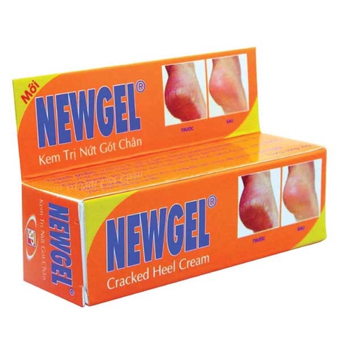 KEM TRỊ NỨT GÓT CHÂN NEWGEL