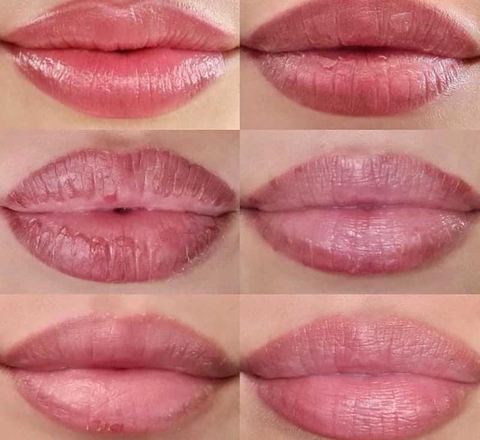 Hút dung dịch hạ màu có gây tổn thương môi không?