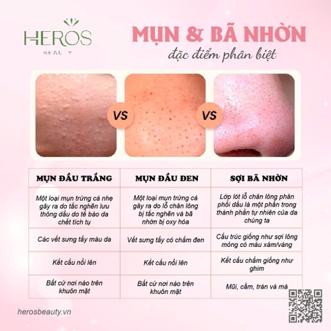 ĐẶC ĐIỂM VÀ CÁCH PHÂN BIỆT MỤN & BÃ NHỜN