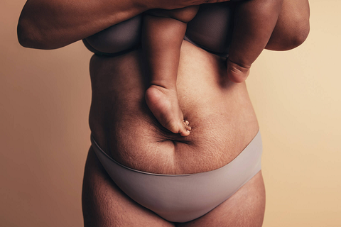 Cách làm nhỏ bụng sau sinh mổ an toàn cho cả mẹ và con