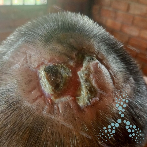 Lành vết thương sau mổ ung thư đầu cổ