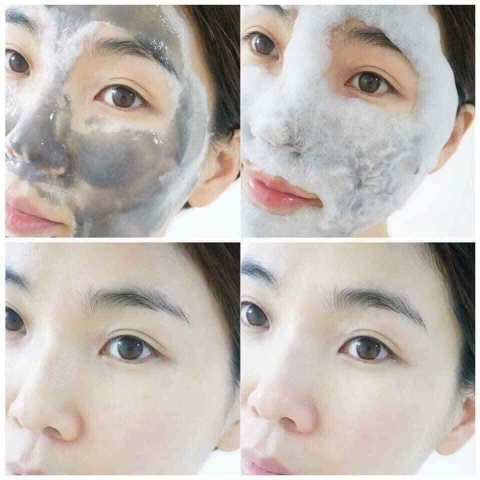 Set thải độc sum trắng 50kw (20ea)