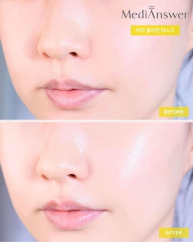 Mặt nạ cấp ẩm căng bóng da Medi Answer Vita Collagen Hộp 5 miếng (32ea)