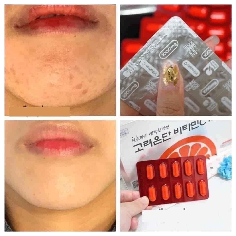Viên uống VITAMIN C EUNDAN 1000 Hàn Quốc