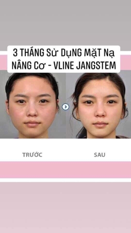 Mặt nạ Vline nâng cơ cổ jangstem bệnh viện vands clinic 49kw hộp 10 miếng (20ae)- VANG01