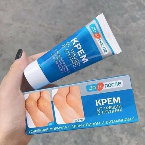 Kem trị nứt gót-Rttng0112
