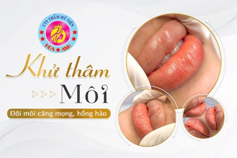 NÊN KIÊNG GÌ SAU KHI KHỬ THÂM MÔI - CÁCH CHĂM SÓC MÔI SAU KHI KHỬ THÂM NHƯ THẾ NÀO