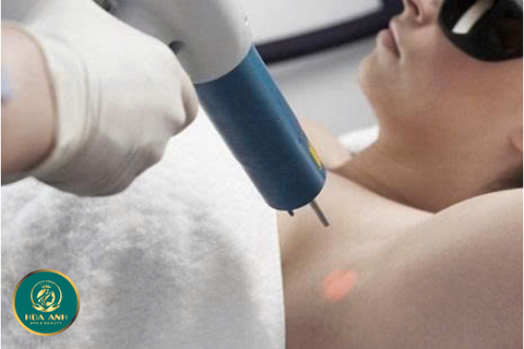 Khóa học Kỹ thuật Plasma Nách – Giải pháp hiện đại cho làn da mịn màng