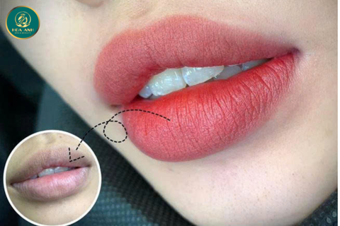 Khóa học Khử Thâm Môi – Cơ hội vàng cho nghề làm đẹp