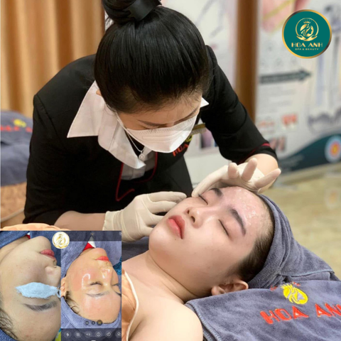 Khóa Học Tiêm Meso - Bí Quyết Thành Công Trong Ngành Làm Đẹp