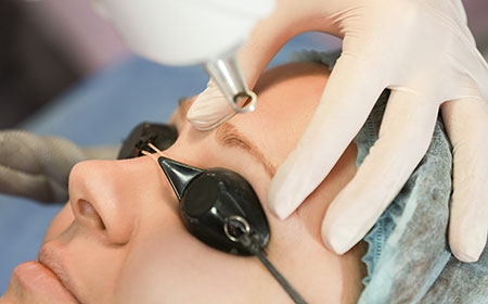 CHÂN MÀY BỊ TRỔ XANH LÀ GÌ ? CHÂN MÀY BỊ TRỔ XANH CÓ LÀM LẠI ĐƯỢC KHÔNG
