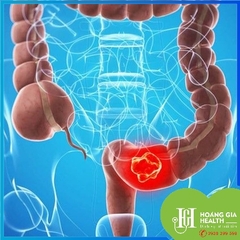 Gói sàng lọc ung thư đại trực tràng - Vinmec / Colorectal cancer screening package