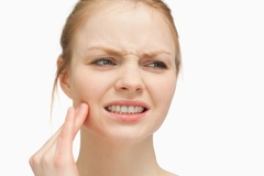 Máng chống nghiến răng Máng chống nghiến răng