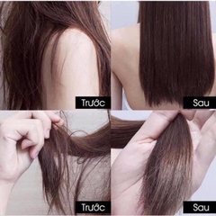 Set dầu gội whoo