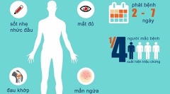 Virut Zika được đưa lên bảng quảng cáo ở Florida