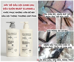 Dầu gội xả Elvawell phục hồi/ kiềm dầu/ trị gầu 500ml-1000ml